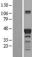 RAB3IL1 Human Over-expression Lysate