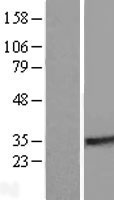 RABL2A Human Over-expression Lysate