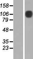 MCK10 (DDR1) Human Over-expression Lysate