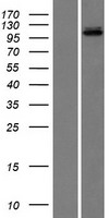 DNA Ligase III (LIG3) Human Over-expression Lysate