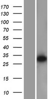 DDAH2 Human Over-expression Lysate