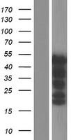 PAX8 Human Over-expression Lysate