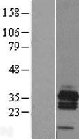 Calcipressin 3 (RCAN3) Human Over-expression Lysate