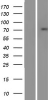 SSX2IP Human Over-expression Lysate