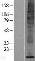 SPCS1 Human Over-expression Lysate