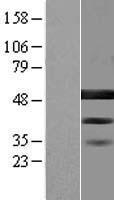 BZW2 Human Over-expression Lysate