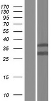 MACROD1 Human Over-expression Lysate