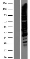 TRPS1 Human Over-expression Lysate