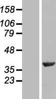 NIPP1 (PPP1R8) Human Over-expression Lysate