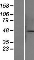 CCDC113 Human Over-expression Lysate