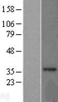MRPL15 Human Over-expression Lysate