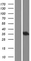CHMP4A Human Over-expression Lysate