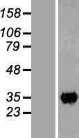 CCDC59 Human Over-expression Lysate