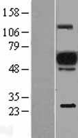 EVI2A Human Over-expression Lysate