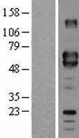 CD5 Human Over-expression Lysate