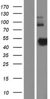 ZNHIT2 Human Over-expression Lysate