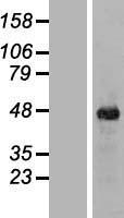 ITPK1 Human Over-expression Lysate