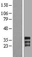 HOXC11 Human Over-expression Lysate