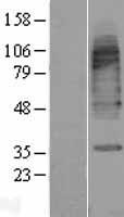 SLC6A11 Human Over-expression Lysate