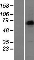 LIMD1 Human Over-expression Lysate