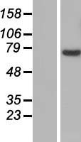 SLC25A13 Human Over-expression Lysate