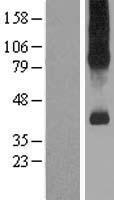 SLC7A9 Human Over-expression Lysate