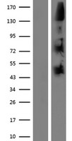 NOMO1 Human Over-expression Lysate