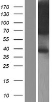 TRAM1 Human Over-expression Lysate