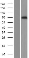 Pescadillo (PES1) Human Over-expression Lysate