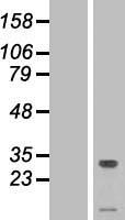 TMEM50A Human Over-expression Lysate