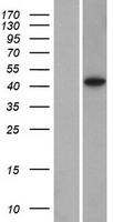 DPS1 (PDSS1) Human Over-expression Lysate