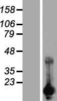 CARHSP1 Human Over-expression Lysate