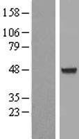 AIPL1 Human Over-expression Lysate