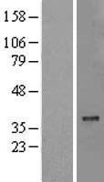 MTCH2 Human Over-expression Lysate