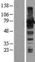 AKAP8L Human Over-expression Lysate