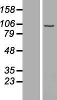 UTP25 Human Over-expression Lysate