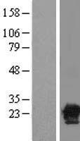 SIAH Interacting Protein (CACYBP) Human Over-expression Lysate