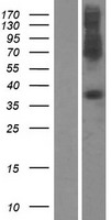 SLC39A1 Human Over-expression Lysate
