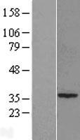 RTDR1 (RSPH14) Human Over-expression Lysate