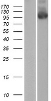 PALD (PALD1) Human Over-expression Lysate