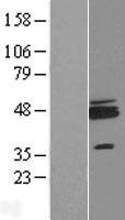 ZNF364 (RNF115) Human Over-expression Lysate