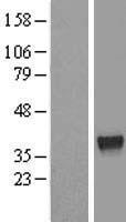 ZNF330 Human Over-expression Lysate