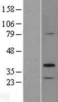 TP53TG5 Human Over-expression Lysate