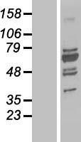 Upstream Binding Protein 1 (UBP1) Human Over-expression Lysate