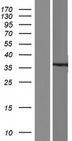 KChIP2 (KCNIP2) Human Over-expression Lysate