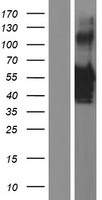 VSX1 Human Over-expression Lysate