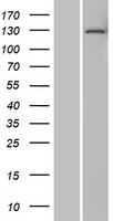 TDIF2 (DNTTIP2) Human Over-expression Lysate