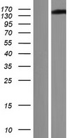 GSE1 Human Over-expression Lysate