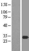 MEA1 Human Over-expression Lysate