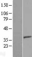 TTC35 (EMC2) Human Over-expression Lysate